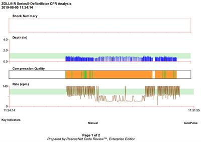 Simulation-Based Training in High-Quality Cardiopulmonary Resuscitation Among Neonatal Intensive Care Unit Providers